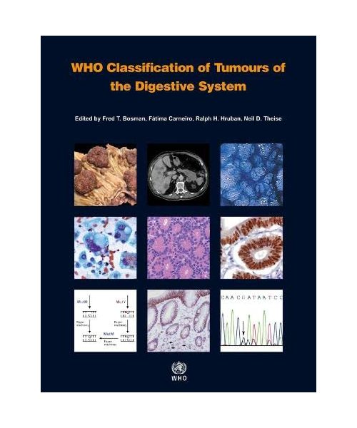 WHO Classification of Tumours of the Digestive System