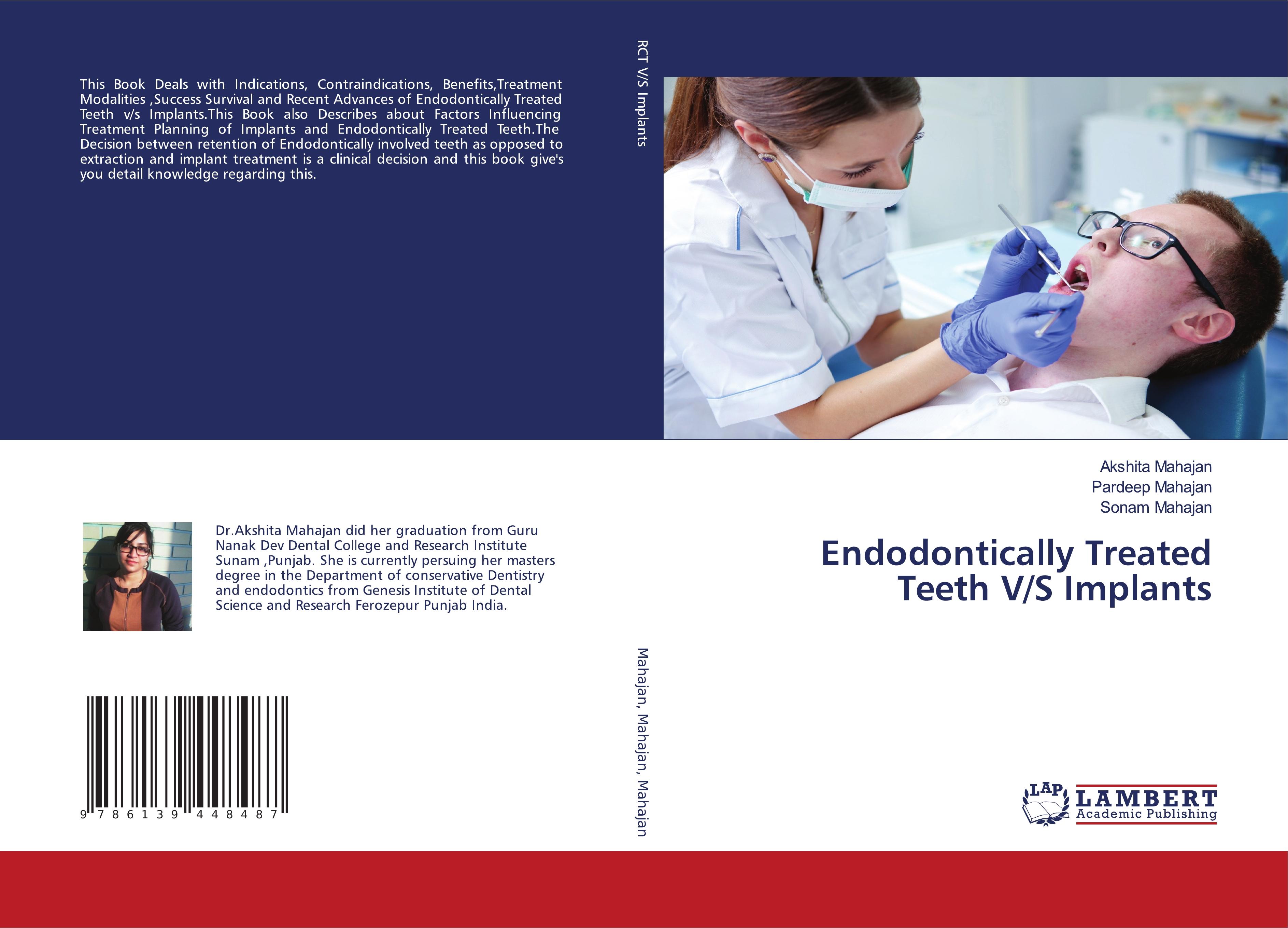 Endodontically Treated Teeth V/S Implants
