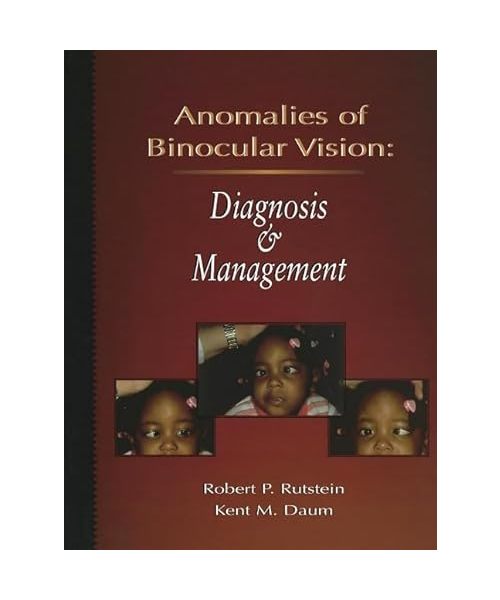 Anomalies Of Binocular Vision