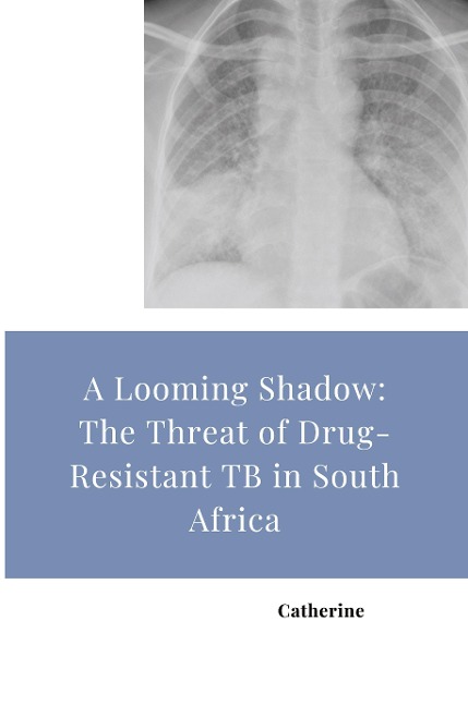 A Looming Shadow: The Threat of Drug-Resistant TB in South Africa