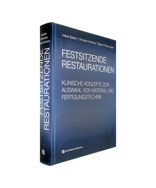 Festsitzende Restaurationen