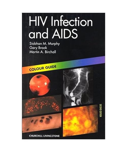 HIV Infection and AIDS.