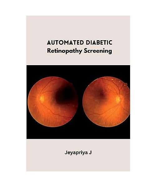 Automated Diabetic Retinopathy Screening
