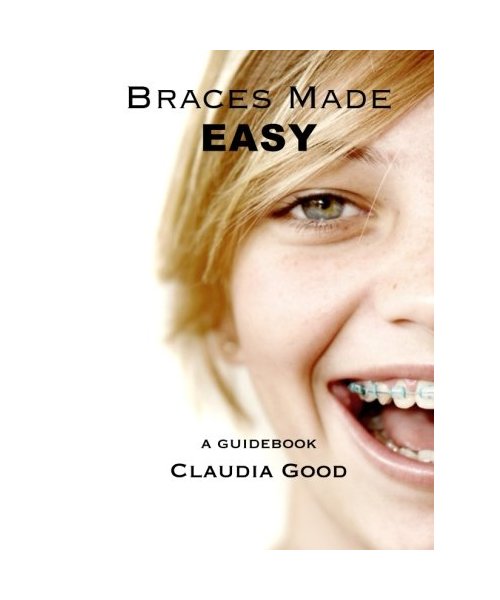 Braces Made Easy: A Guidebook For Braces