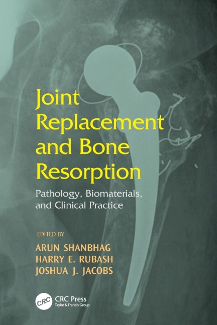 Joint Replacement and Bone Resorption