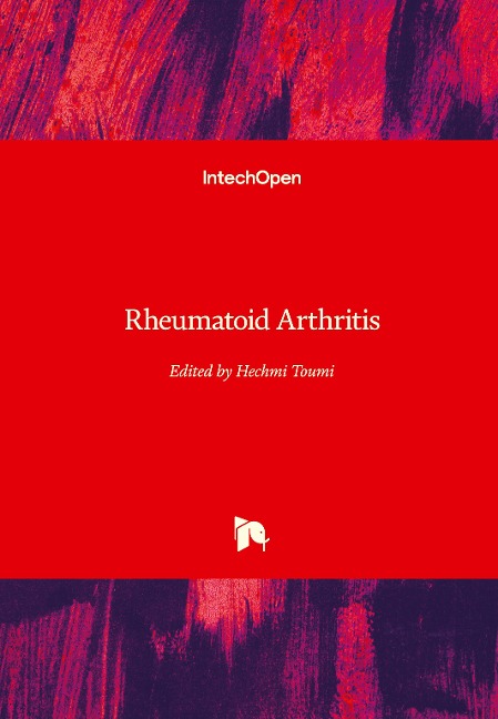 Rheumatoid Arthritis