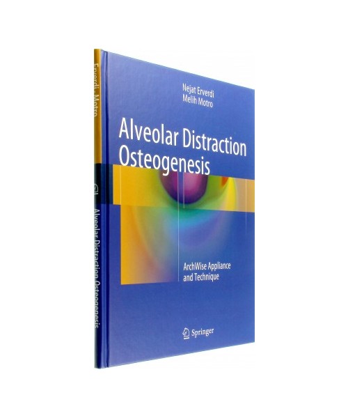 Alveolar Distraction Osteogenesis