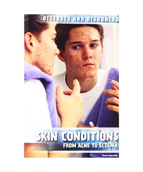 Skin Conditions: From Acne to Eczema (Diseases and Disorders)