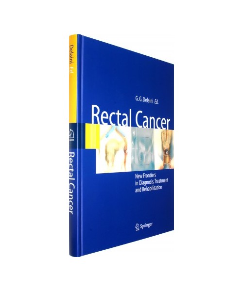 Rectal Cancer
