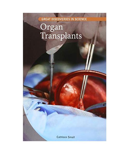 Organ Transplants