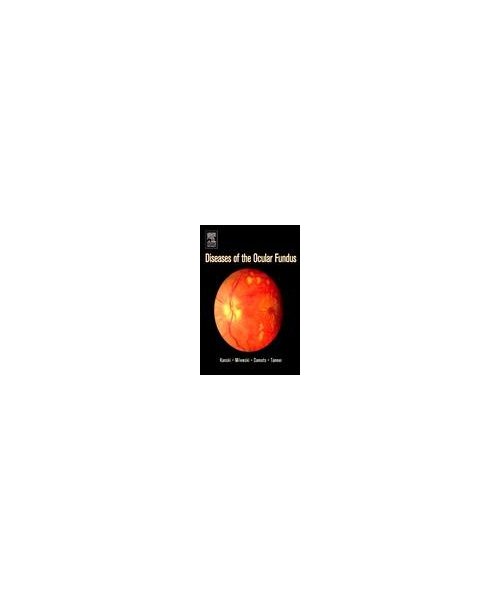 Diseases of the Ocular Fundus