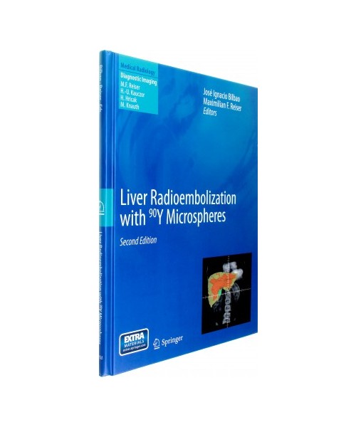 Liver Radioembolization with 90Y Microspheres