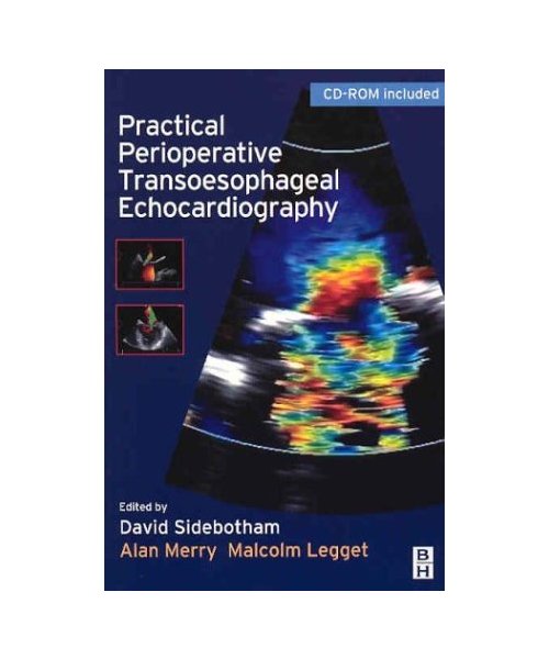Practical Perioperative Transesophageal Echocardiography