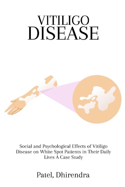 Social and Psychological Effects of Vitiligo Disease on White Spot Patients in Their Daily Lives A Case Study