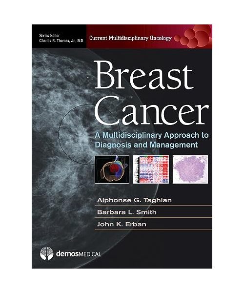 Breast Cancer: A Multidisciplinary Approach to Diagnosis and Management