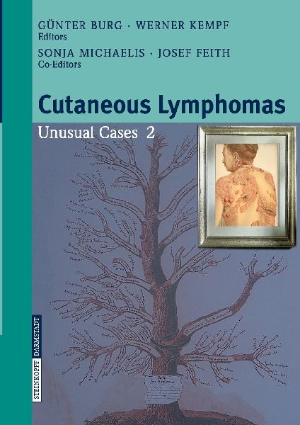 Cutaneous Lymphomas