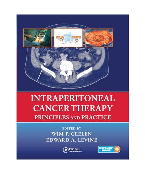 Intraperitoneal Cancer Therapy