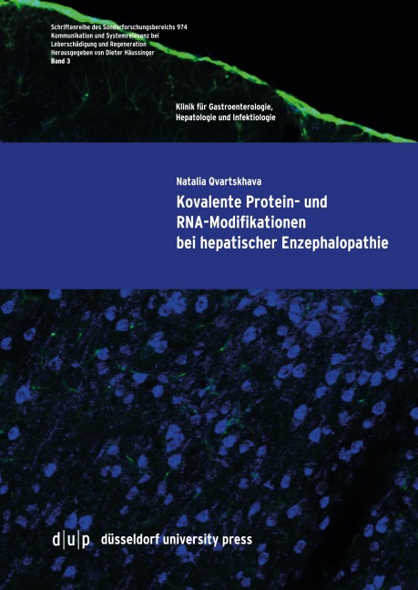 Kovalente Protein- und RNA-Modifikationen bei hepatischer Enzephalopathie