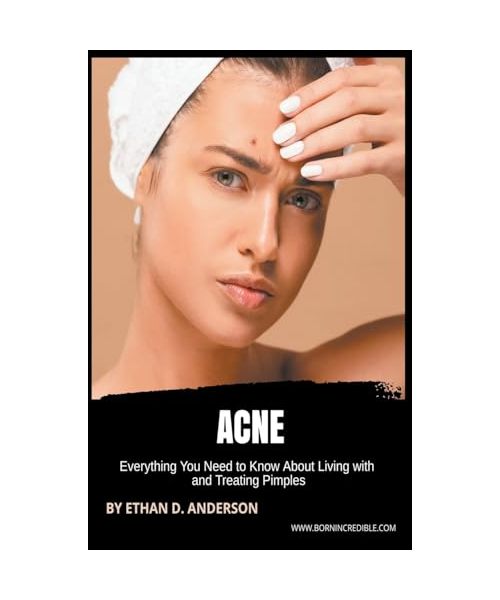 Acne