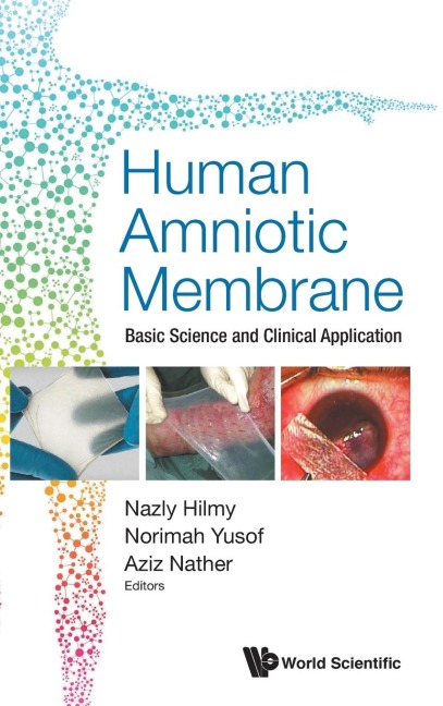 HUMAN AMNIOTIC MEMBRANE