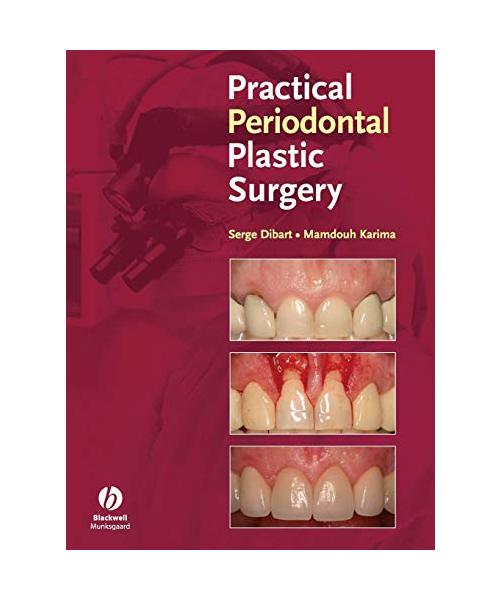 Periodontal Plastic Surgery