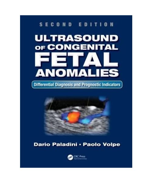 Ultrasound of Congenital Fetal Anomalies