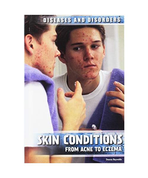 Skin Conditions: From Acne to Eczema