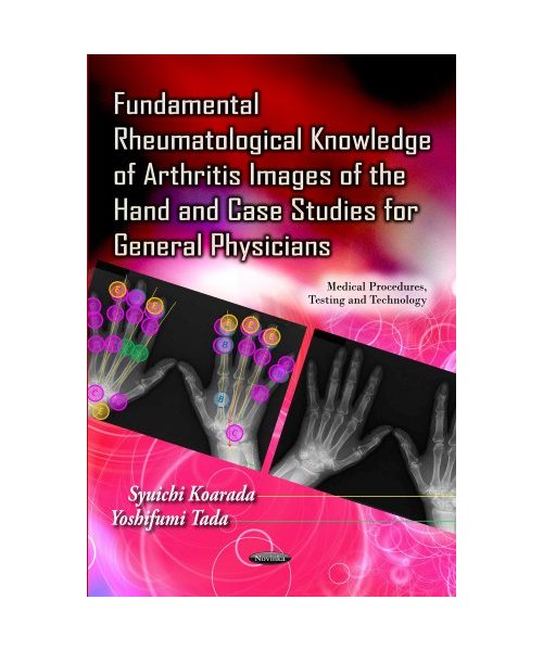 Fundamental Rheumatological Knowledge of Arthritis Images of the Hand & Case Studies for General Physicians