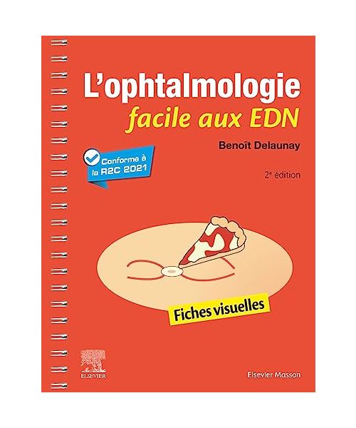 L'ophtalmologie facile aux EDN: Fiches visuelles