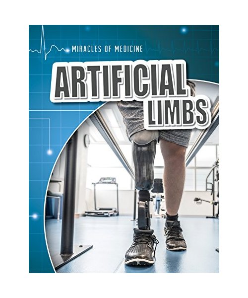 Artificial Limbs