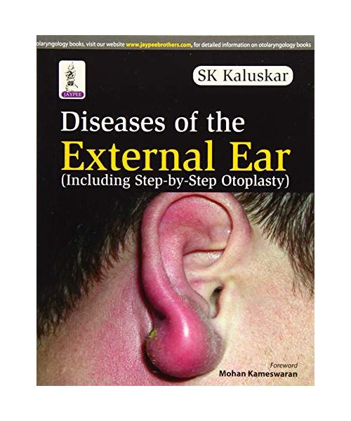 Diseases of the External Ear