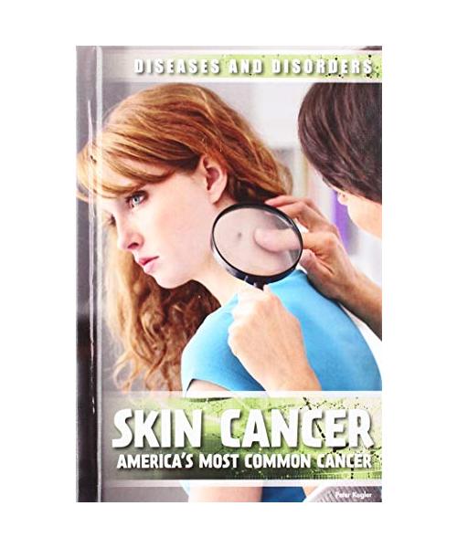 Skin Cancer